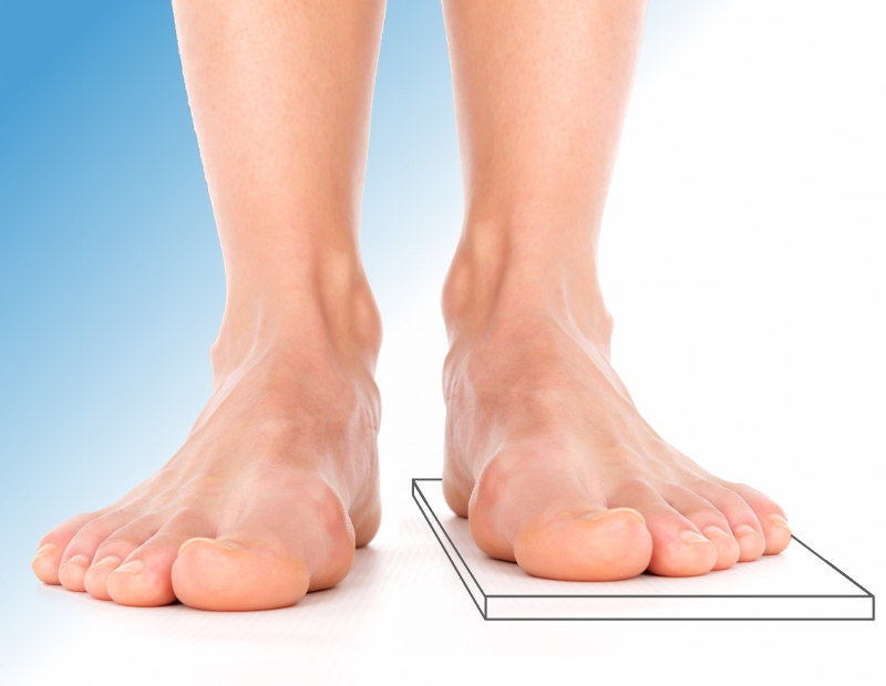 feet-plus-chiropody-podiatry-clinics-leg-length-discrepancy